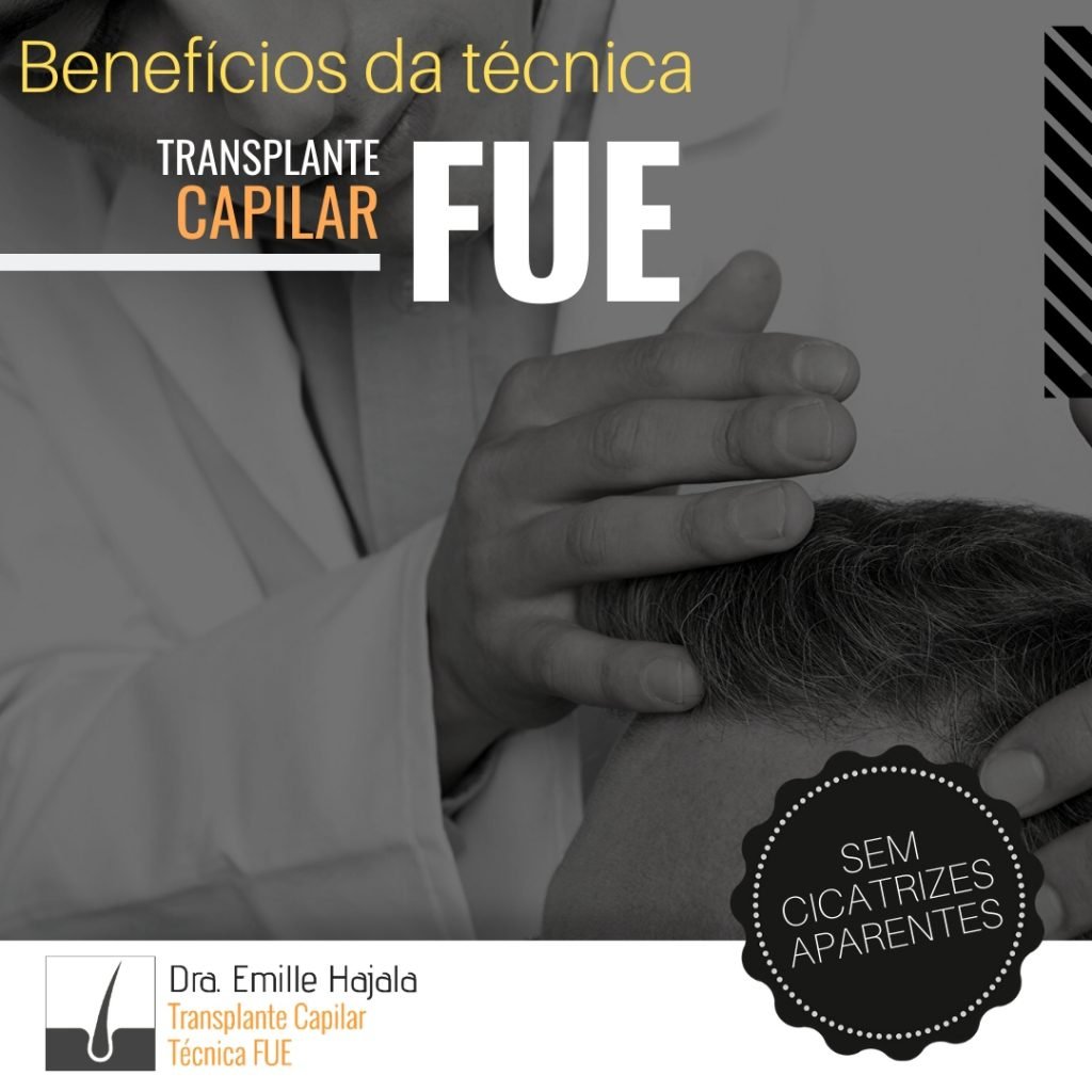 beneficios da tecnica fue