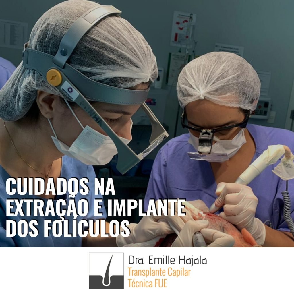 cuidados na extração e implante dos folículos