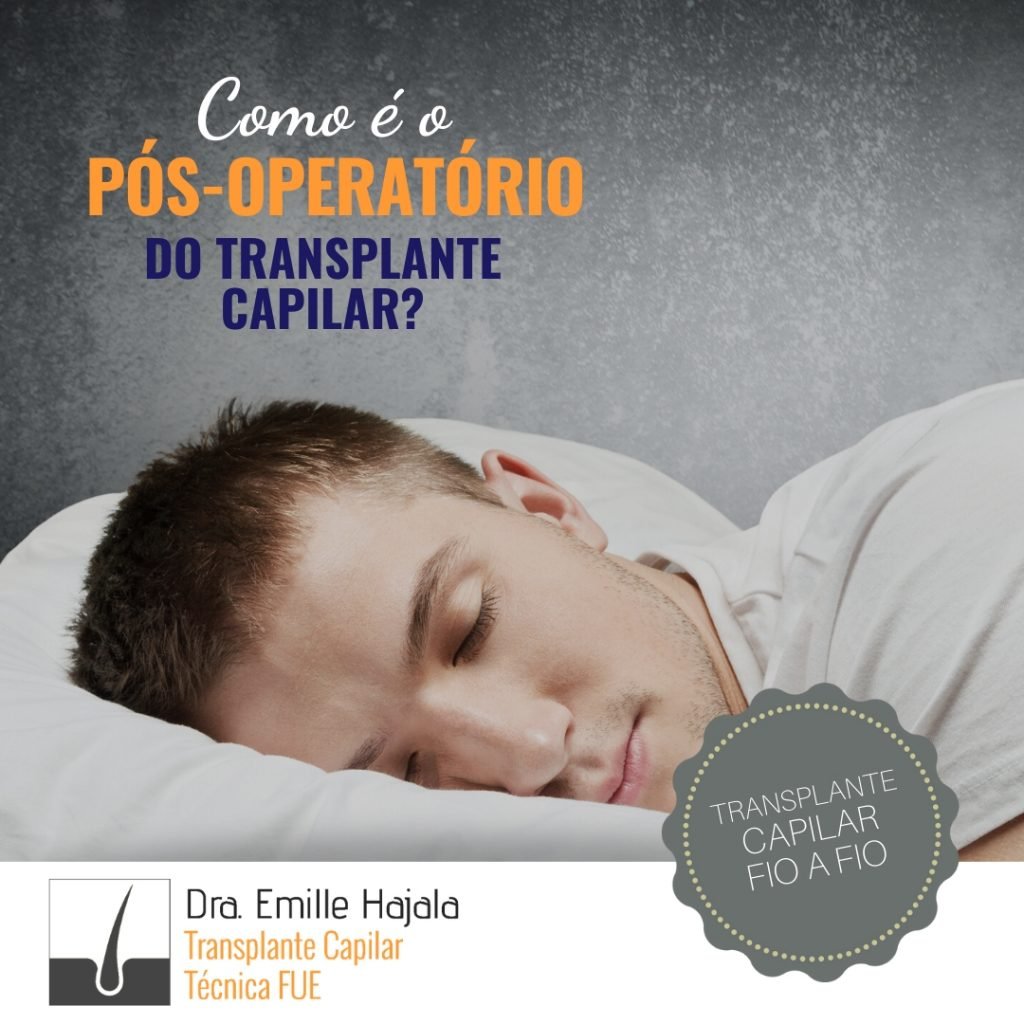 transplante capilar como é o pós-operatorio do transplante capilar