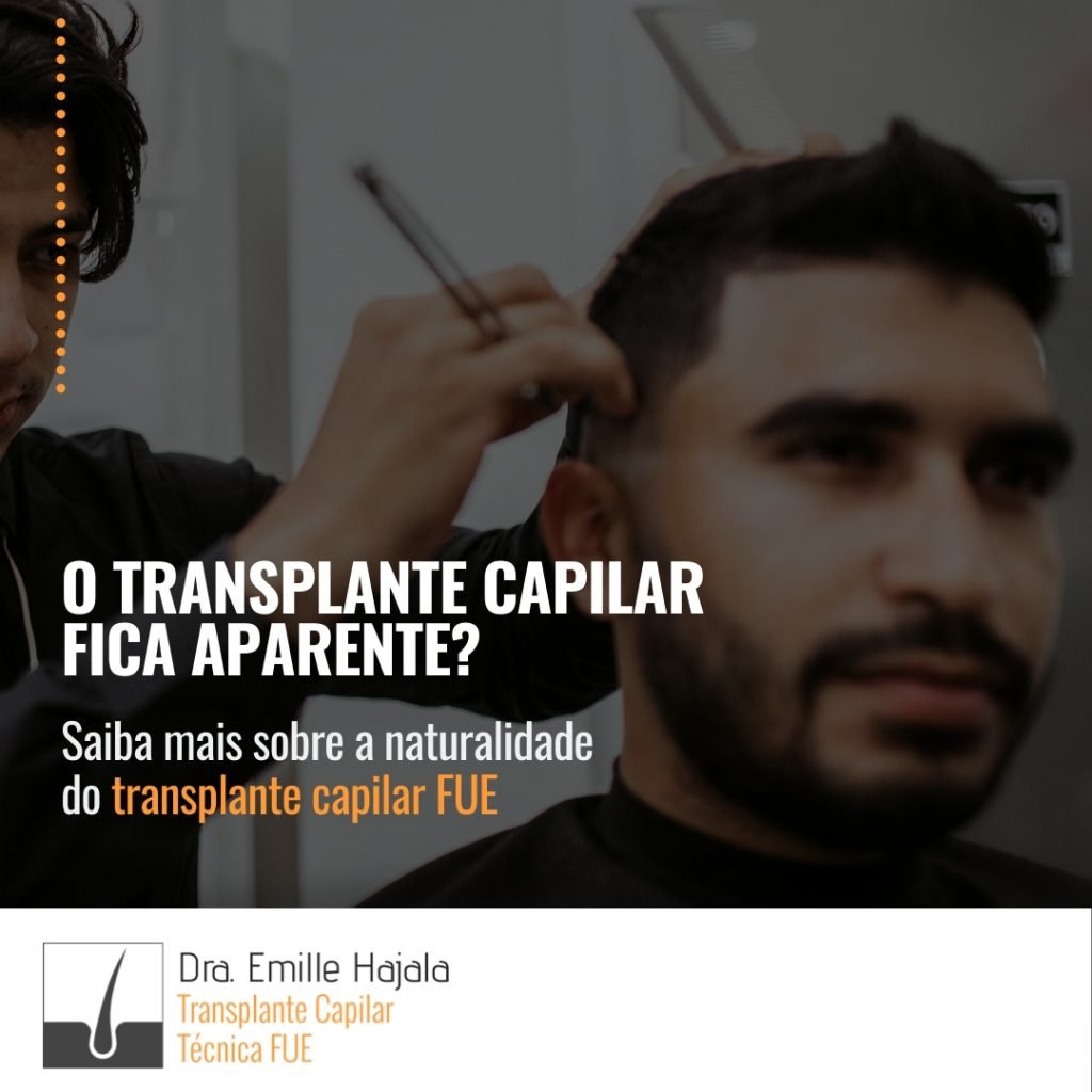 transplante capilar fica aparente