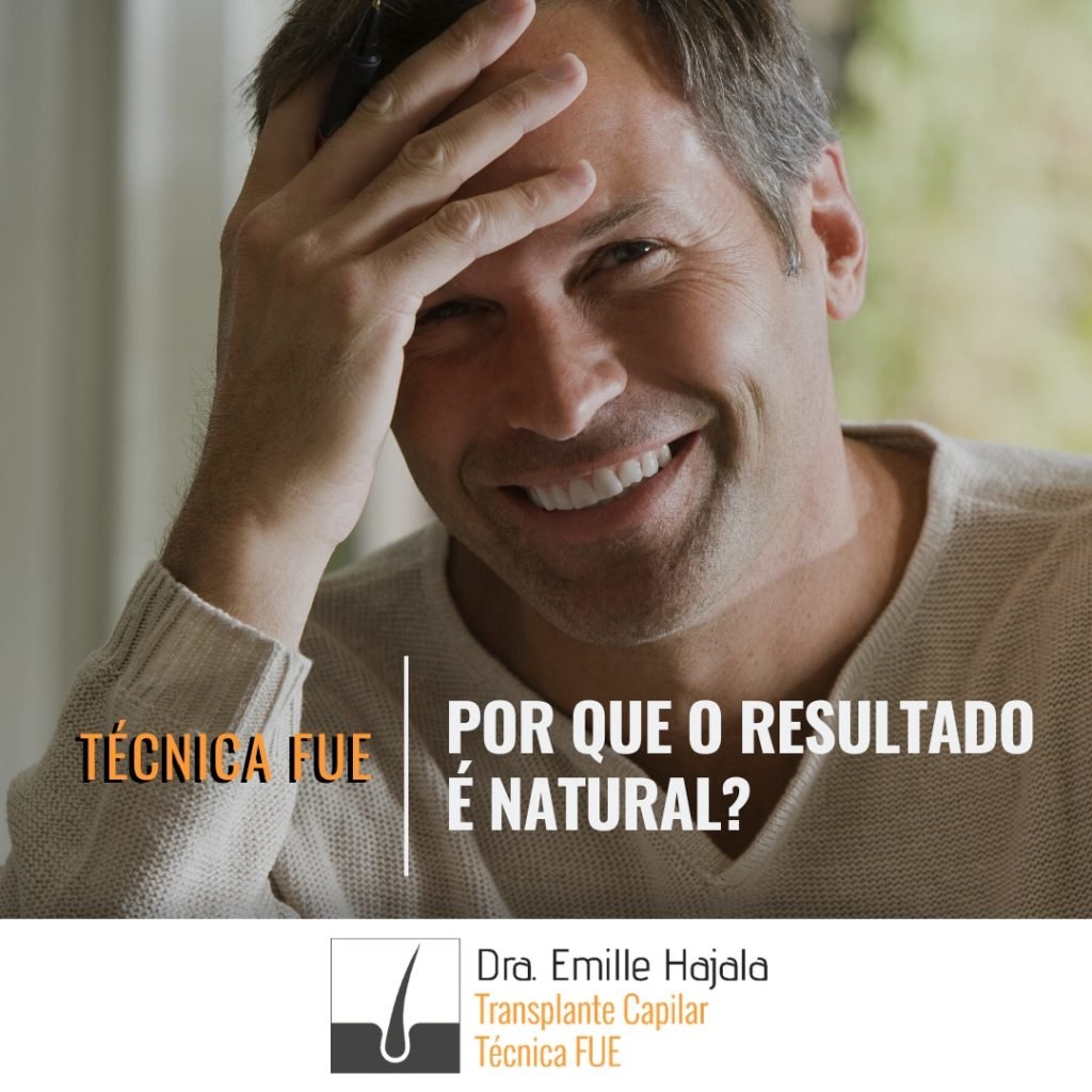 transplante capilar por que o resultado é natural