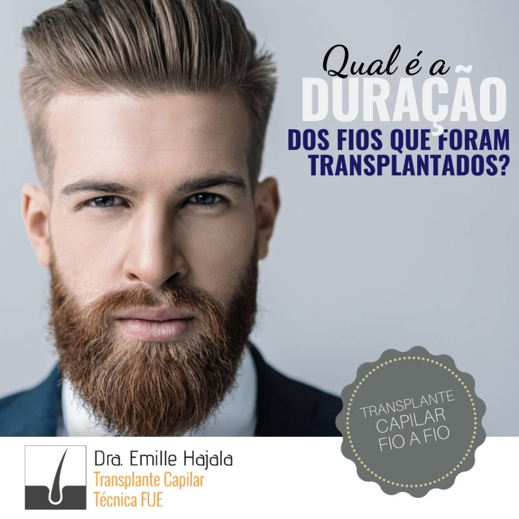 qual é a duração dos fios que foram transplantados