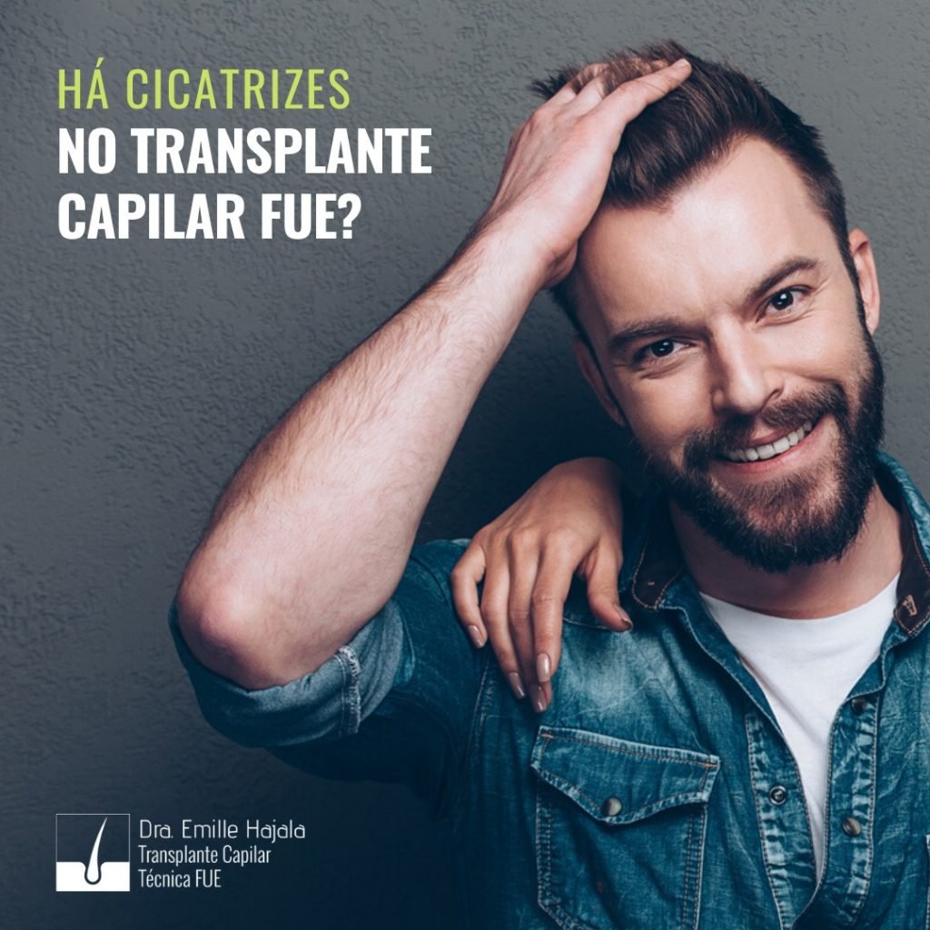 há cicatrizes no transplante capilar fue?